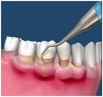 1545976102821003.jpg 6.jpg